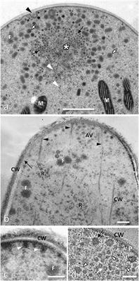 Contributions of Ultrastructural Studies to the Knowledge of Filamentous Fungi Biology and Fungi-Plant Interactions